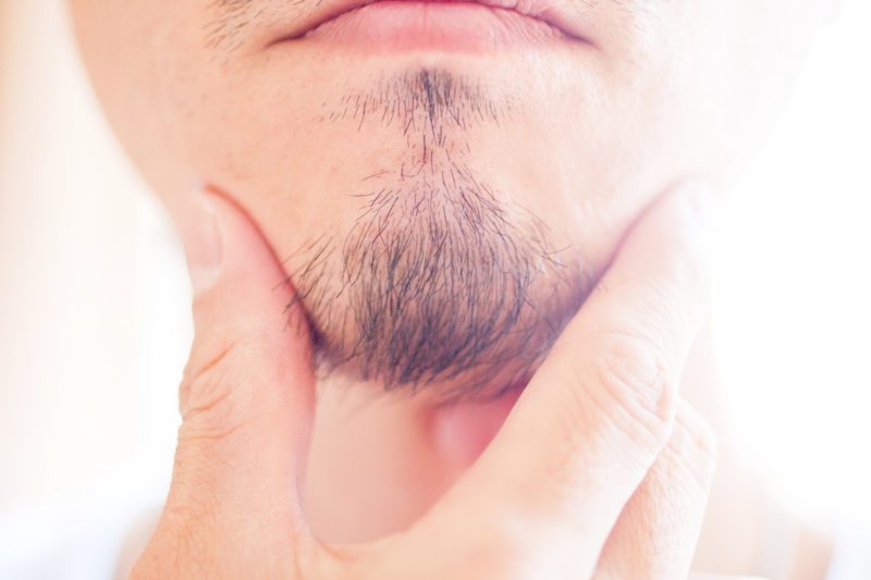 男性がひげ脱毛する６つの理由